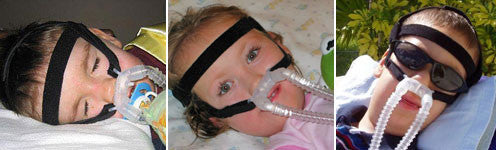 NasalAire II Petite Nasal Prongs
